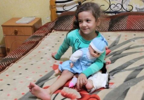 A Palestinian girl who lost her leg